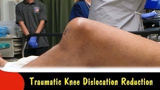 Traumatic Knee Dislocation ReductionQuick Version [upl. by Loggins]