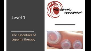 Essentials of Cupping Therapy Free Training [upl. by Shurlock]