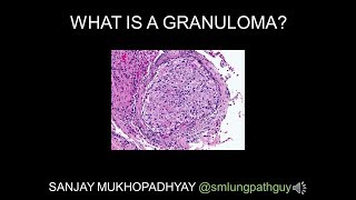 New treatment for granuloma annulare shows promise [upl. by Huey]