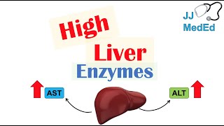 High Liver Enzymes  Aspartate vs Alanine Aminotransferase AST vs ALT  Causes [upl. by Nnuahs]