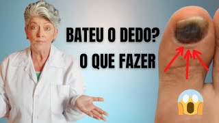 Como Tratar Hematoma na Unha [upl. by Yniatirb]