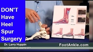 Heel Spur Treatment – How to Avoid Heel Spur Surgery  Seattle Podiatrist [upl. by Michi]