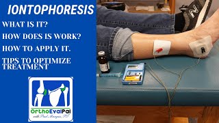 Iontophoresis for Inflammation with OrthoEvalPal [upl. by Zebedee781]