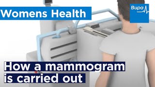 How a mammogram is carried out  Bupa Health [upl. by Ardnuhsor]