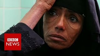 On brink of worst famine in 100 years  BBC News [upl. by Ezarra]