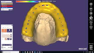 Occlusal Night Guard Design and Print Using Exocad and Formlabs 2 [upl. by Doug]