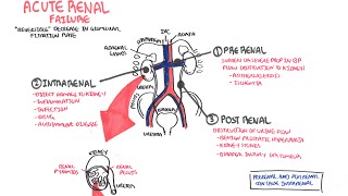 Acute Renal Failure [upl. by Fusco]