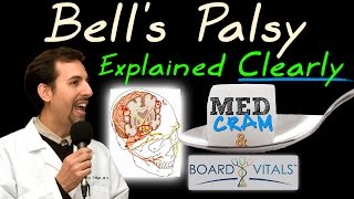 The Difference Between Bells Palsy and Stroke Symptoms [upl. by Elahcar]