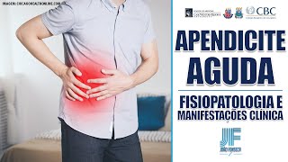 APENDICITE AGUDA Parte 1 Anatomia Epidemiologia e Fisiopatologia 👨🏽‍⚕‍🚑 Joao Fonseca [upl. by Ashil]