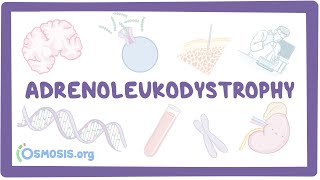 Adrenoleukodystrophy  causes symptoms diagnosis treatment pathology [upl. by Cleary]