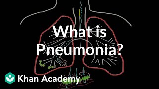 What is pneumonia  Respiratory system diseases  NCLEXRN  Khan Academy [upl. by Johnathan607]