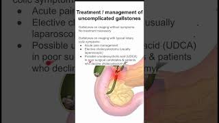 Treatment  management of uncomplicated gallstones [upl. by Witherspoon681]