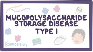 Mucopolysaccharide Storage Disease Type I Hurler HurlerScheie and Scheie syndromes [upl. by Llenrahc]