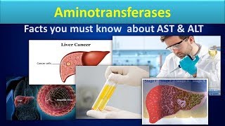 AminotransferaseClear overview about ASTALT [upl. by Marquez]