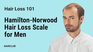 HamiltonNorwood Hair Loss Scale for Men  Male Pattern Baldness [upl. by Hughett638]