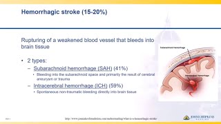 Subarachnoid Hemorrhage  The Heart Course [upl. by Sulecram]