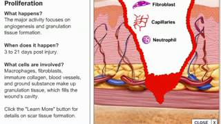 How to Apply DERMABOND ADVANCED Skin Adhesive  JampJ MedTech [upl. by Mandelbaum]