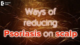 What helps psoriasis on scalp  Dr Rasya Dixit [upl. by Bedwell]