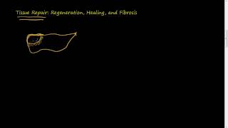 31 Tissue Repair Regeneration Healing Fibrosis [upl. by Arol]