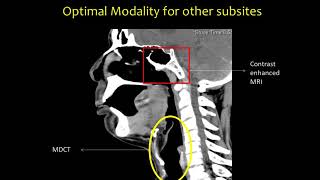 Head and Neck Anatomy Dr Abhishek Mahajan [upl. by Maye]