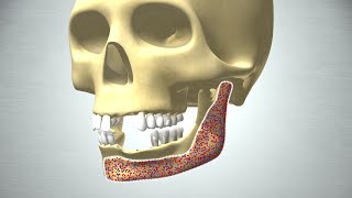 Revolution in Bone Regeneration [upl. by Bolen]