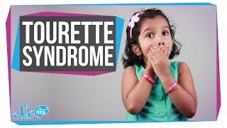 Angelman Syndrome Causes Signs and Symptoms Diagnosis and Treatment [upl. by Bust]