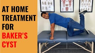 4 Self Treatments For Baker’s Cysts In The Knee [upl. by Brunelle900]