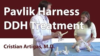 Pavlik Harness DDH Treatment [upl. by Greggory]