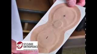 St Cloud Orthopedics  Iontophoresis Medicine Patch [upl. by Walsh]