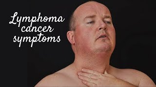 LYMPHOMA CANCER SYMPTOMS [upl. by Atterahs]