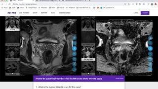 MRI PRO Prostate MRI Training Course  Tutorial [upl. by Mir]