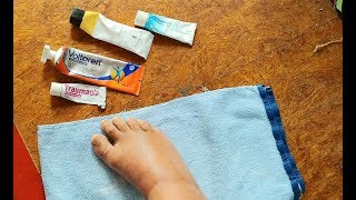 Heilende Salben bei Entzündungen Retterspitz Voltaren Schmerzgel Forte Traumaplant Bebanthen [upl. by Oalsinatse]