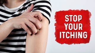 What Causes Hives and Itchiness  Urticaria Hives Treatment  Dr Berg [upl. by Zarihs]