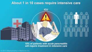 Management and Treatment of Acute Pancreatitis [upl. by Auod]