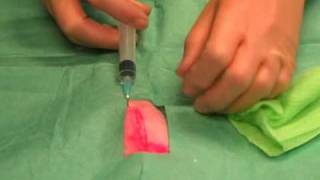 Simple Buried Suture  Learn Suture Techniques [upl. by Rebmac]