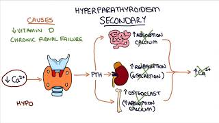 Understanding Hyperparathyroidism [upl. by Ennoirb]