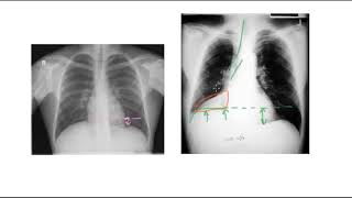 Notions de physiologie respiratoire [upl. by Adnilam295]