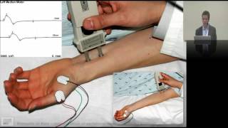 25 Interpreting neurophysiology EMG amp NCS [upl. by Sidman]