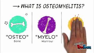 Osteomyelitis [upl. by Asyla]