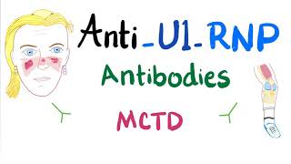 AntiU1Ribonucleoprotein AntiU1RNP autoantibodies [upl. by Lowndes]