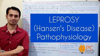 Leprosy Pathophysiology Hansens Disease Part 1 Introduction Types and Etiology [upl. by Idnas]