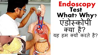 Endoscopy test in Hindi [upl. by Tonry]