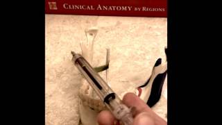 Regional Nerve Blocks for Orthopaedic Surgery  Devin McCullough DO [upl. by Asabi]