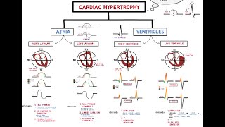 Ventricular Rhythms  EKG Interpretation  LevelUpRN [upl. by Roselane935]