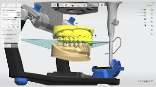 How To Get Started with 3Shape Splint Studio for Night Guards [upl. by Laktasic]