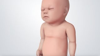 Infant Distress Warning Signs Grunting Baby Sound [upl. by Eelaroc]