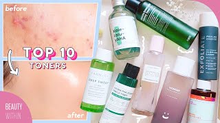 Best Toners for Acne Hyperpigmentation Large Pores Whiteheads amp Blackheads [upl. by Lekim]