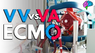 ECMO at UHSM [upl. by Teerprug614]