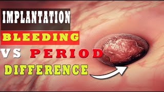 Implantation Bleeding Vs Period – How to Know the Difference 🩸🩸 [upl. by Lesh]