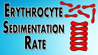 Erythrocyte Sedimentation Rate [upl. by Larred92]